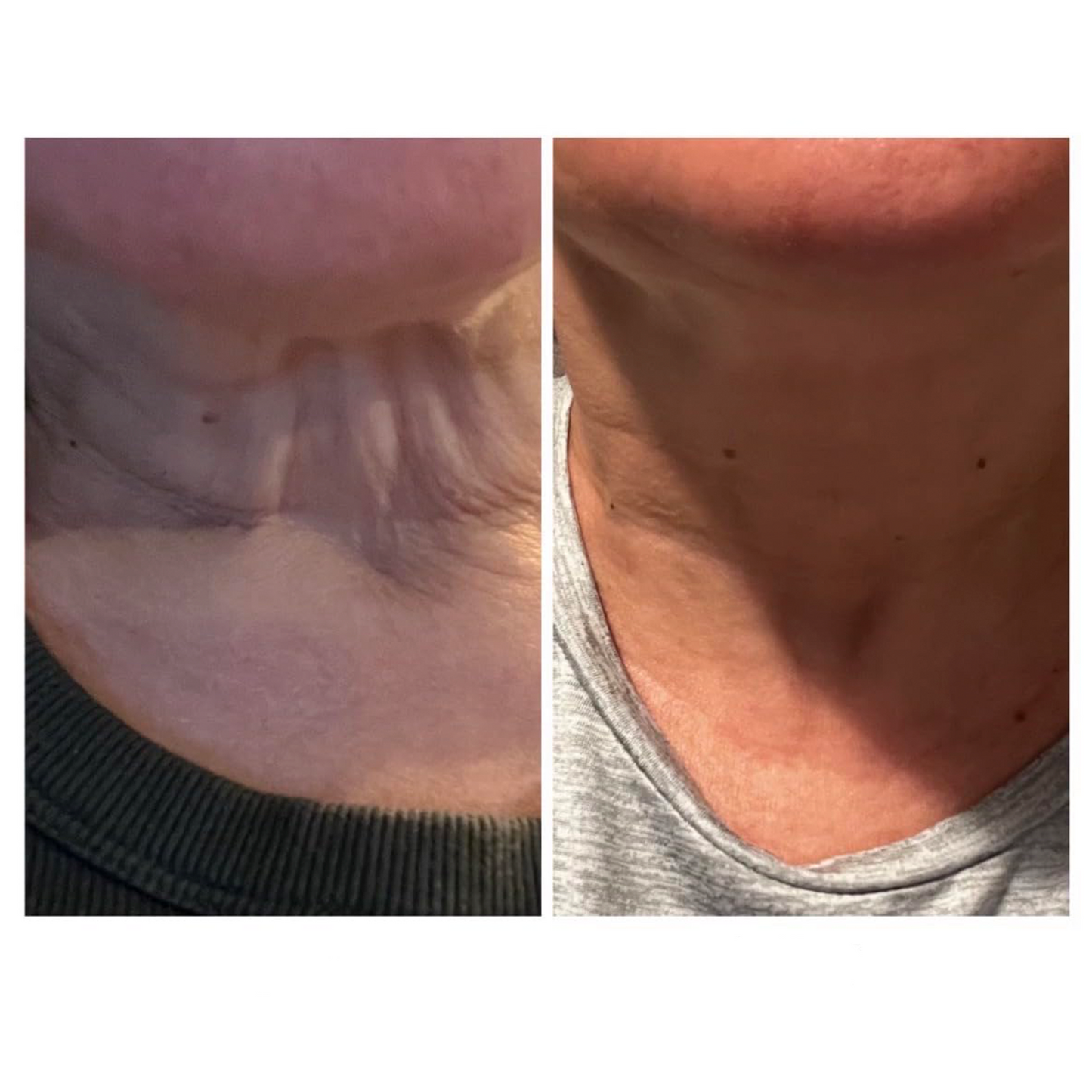 Mascarilla Reafirmante de Colágeno + Péptidos para Rostro y Cuello