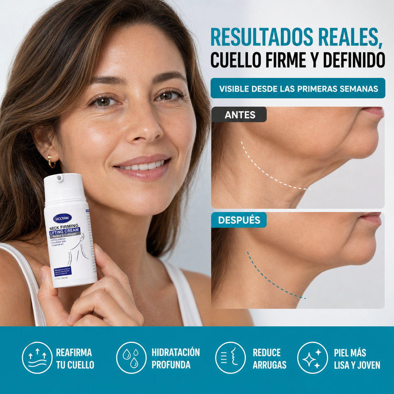 Crema Reafirmante para Cuello y Papada – Efecto Lifting y Anti-Arrugas | RejuvaNeck™