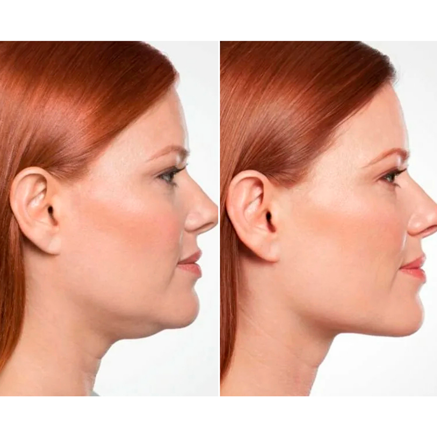 Mascarilla Reafirmante de Colágeno + Péptidos para Rostro y Cuello